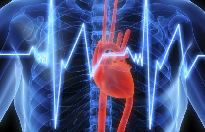 סדרת מפגשים בנושא אי ספיקת לב | מפגש 2 | הטיפול בחולה עם אי ספיקת לב מתקדמת