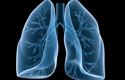 מחלות ריאה אינטרסטיציאליות ופיברוטיות – אבחון , טיפול וחידושים