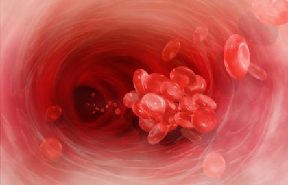 PCSK9 עידן חדש בטיפול בטרשת עורקים